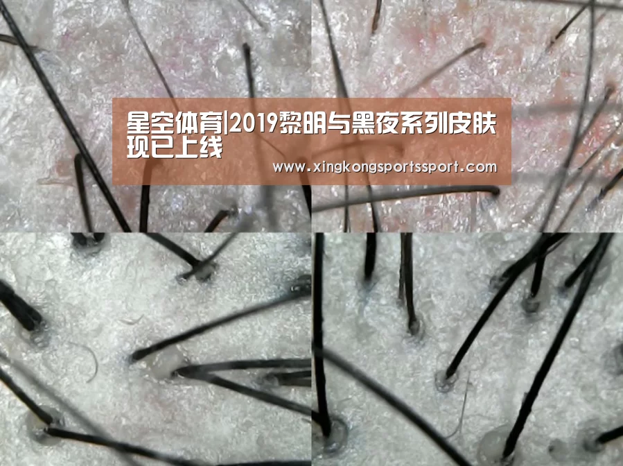 星空体育|2019黎明与黑夜系列皮肤现已上线(图3) 星空体育|2019黎明与黑夜系列皮肤现已上线(图3)
